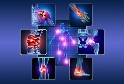 Immunological Arthritis